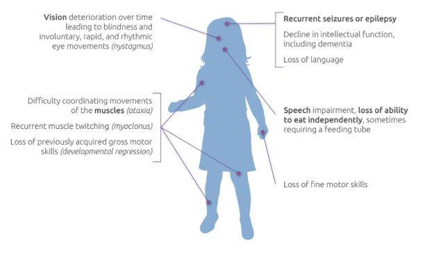 batten-disease-symptoms